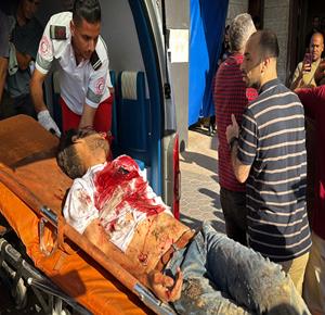 وصول شهداء وجرحى بقصف إسرائيلي إلى مستشفى الأقصى في دير البلح وسط قطاع غزة