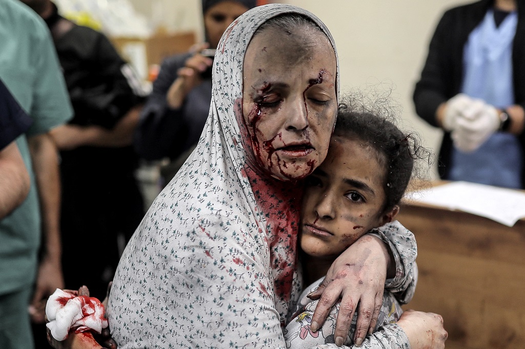 أم وطفلتها تصلان إلى مستشفى ناصر في خان يونس لتلقي العلاج عقب إصابتهما في غارة إسرائيلية (تصوير: أ ف ب)