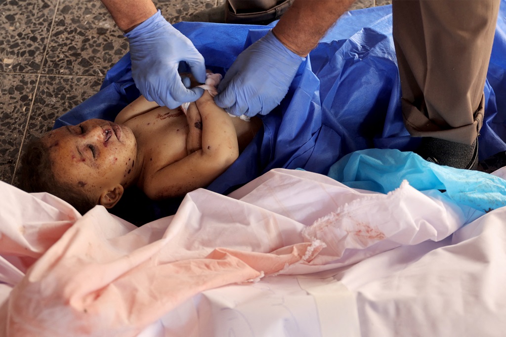 جثمان طفل شهيد في مستشفى المعمداني بمدينة غزة (أ ف ب)