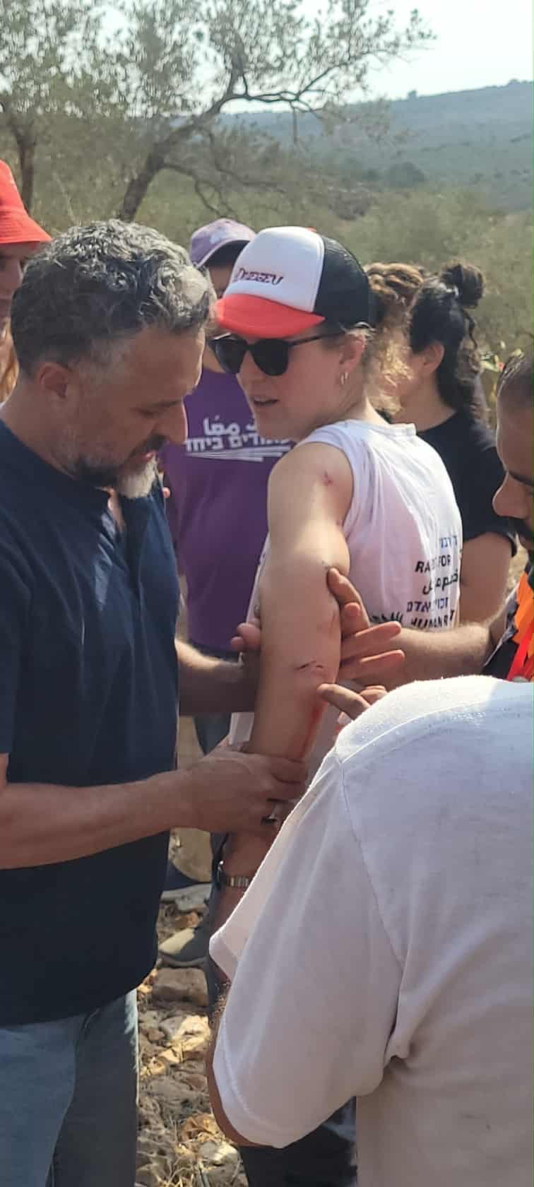 متضامنون تعرضوا لهجوم مستعمرين في ديراستيا