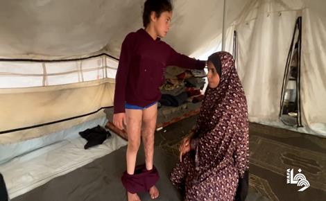  رنين جندية مصابة بحروق وتحتاج للعلاج خارج غزة