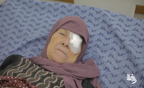 حصار الاحتلال يُفاقم معاناة مرضى العيون في غزة