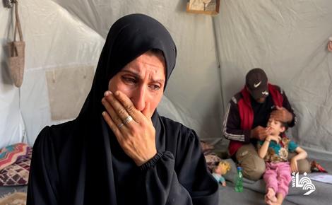 الطفلة داليا تعاني من نقص الأكسجين وسوء التغذية 