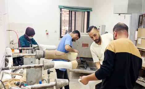صناعة أطراف صناعية بإمكانيات محدودة في غزة