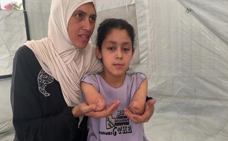 سارة تواجه قسوة الحياة بلا ذراعين