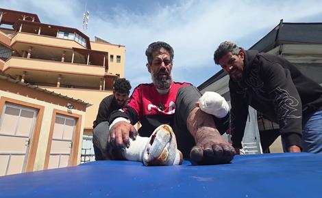 مصعب يواجه خطر فقدان أطرافه تدريجيًا 